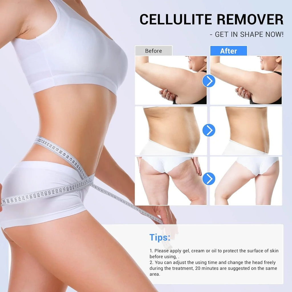 Dispositivo para Mejorar el Aspecto de la Celulitis, Masajeador Anticelulítico con Radiofrecuencia para Uso Doméstico