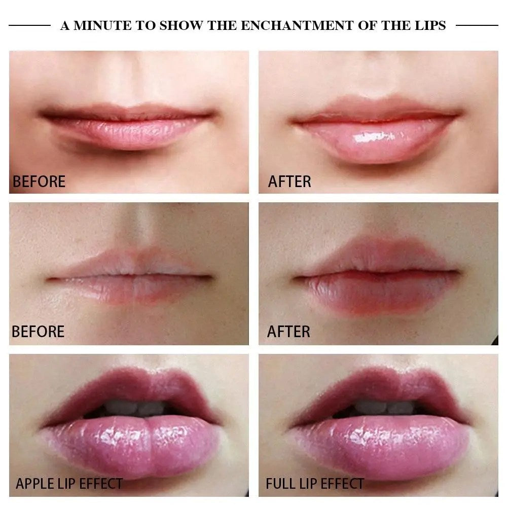 Dispositivo Premium Manual para Voluminizar Labios